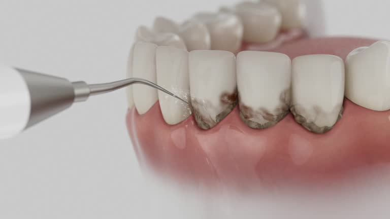 Trusted Wisdom Tooth Removal service in Santa Clara, OR - Dentist Open Now